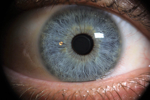 blaue Augen