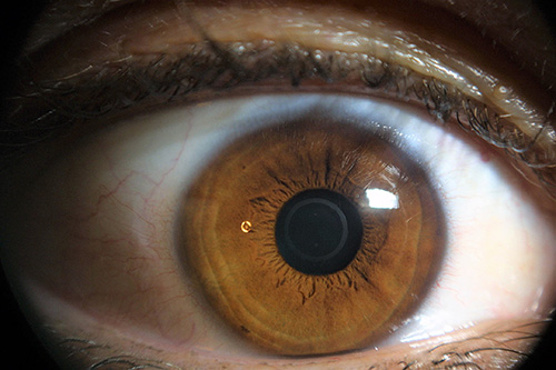 blaue Augen