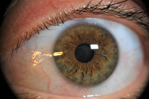blaue Augen